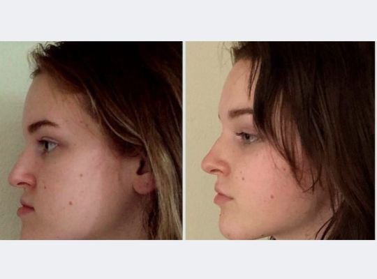 Jaw surgery treatment at Dhruv Dental Clinic in Ghatkopar West